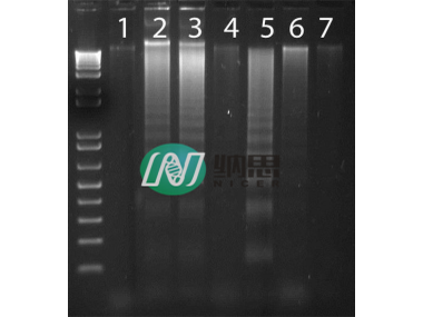 DNA ladder